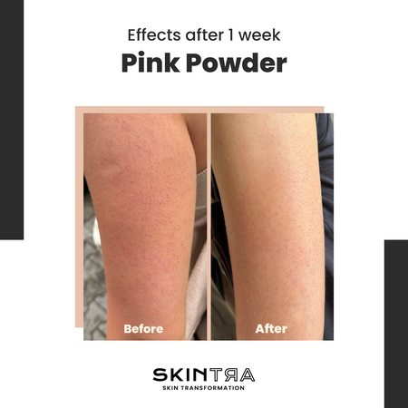 SkinTra - Pink Pow(d)er - Multifunctional Cleansing-Enzymatic Powder on Clay Base - 40g - Image 2