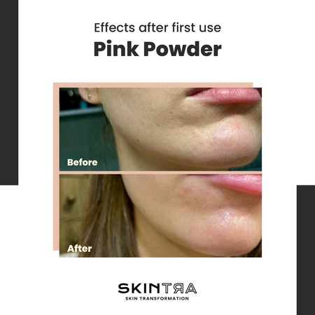 SkinTra - Pink Pow(d)er - Multifunctional Cleansing-Enzymatic Powder on Clay Base - 40g - Image 3