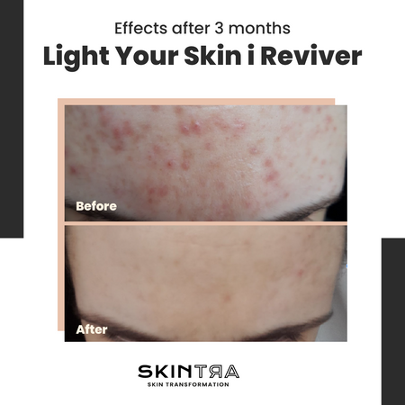 SkinTra - Reviver - Revitalizing Serum - 30ml - Image 2